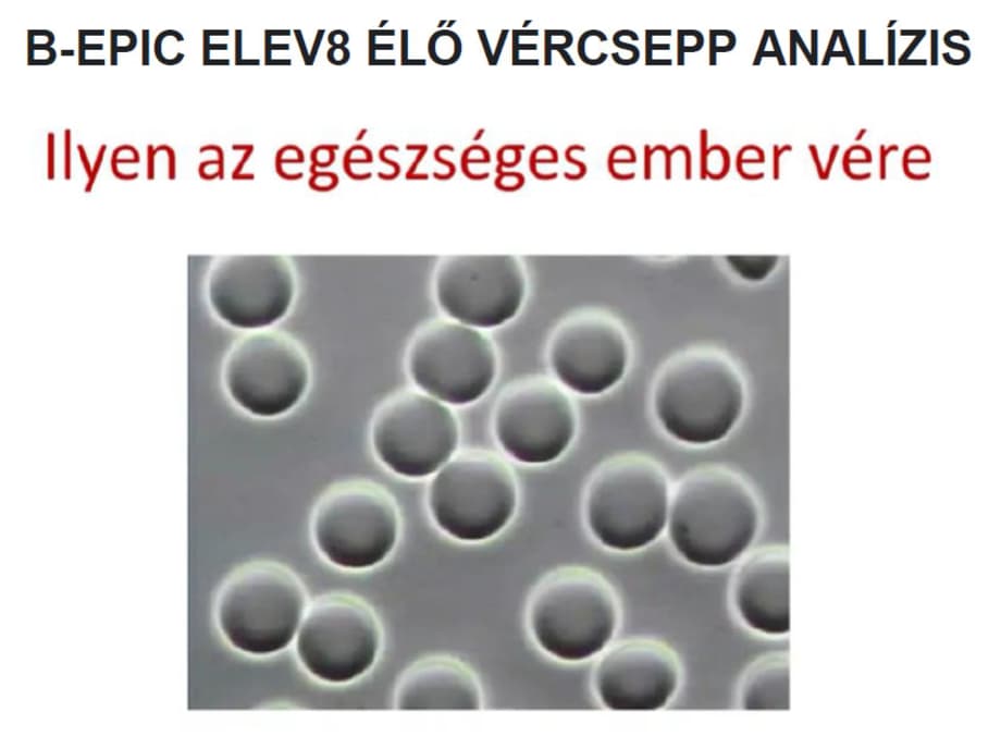B-EPIC_ELEV8_ELO_VERCSEPP_ANALIZIS B-EPIC_ELEV8_ELO_VERCSEPP_ANALIZIS